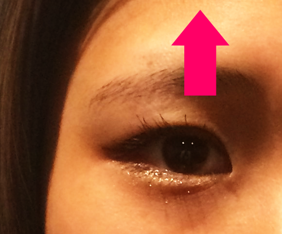 美顔鍼を受けた後の女性の目元。むくみが取れ目が大きくなっている。