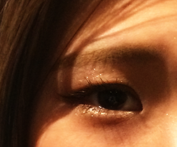 美顔鍼を受ける前の女性の目元