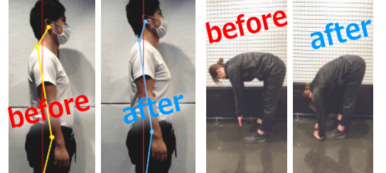 施術前後の姿勢写真
