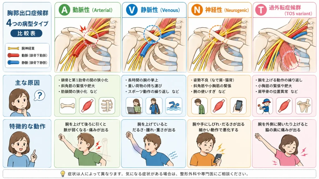 胸郭出口症候群の4つの病型タイプ比較図