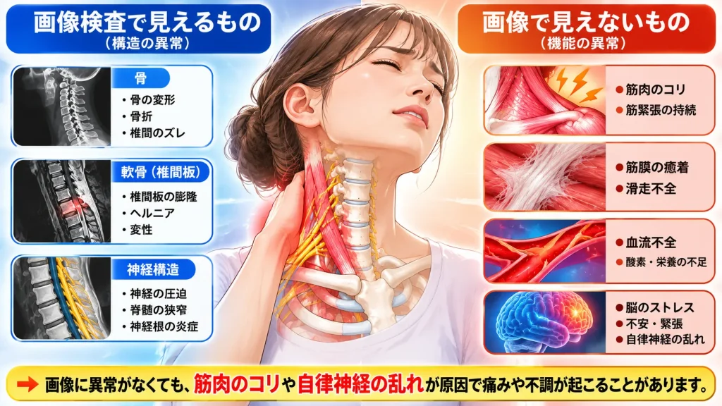 左側：画像検査で見えるもの（骨・軟骨・神経構造）。右側：画像で見えないもの（筋肉のコリ・筋膜の癒着・血流不全・脳のストレス・自律神経の乱れ）